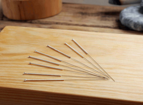 Acupuncture during IVF treatment