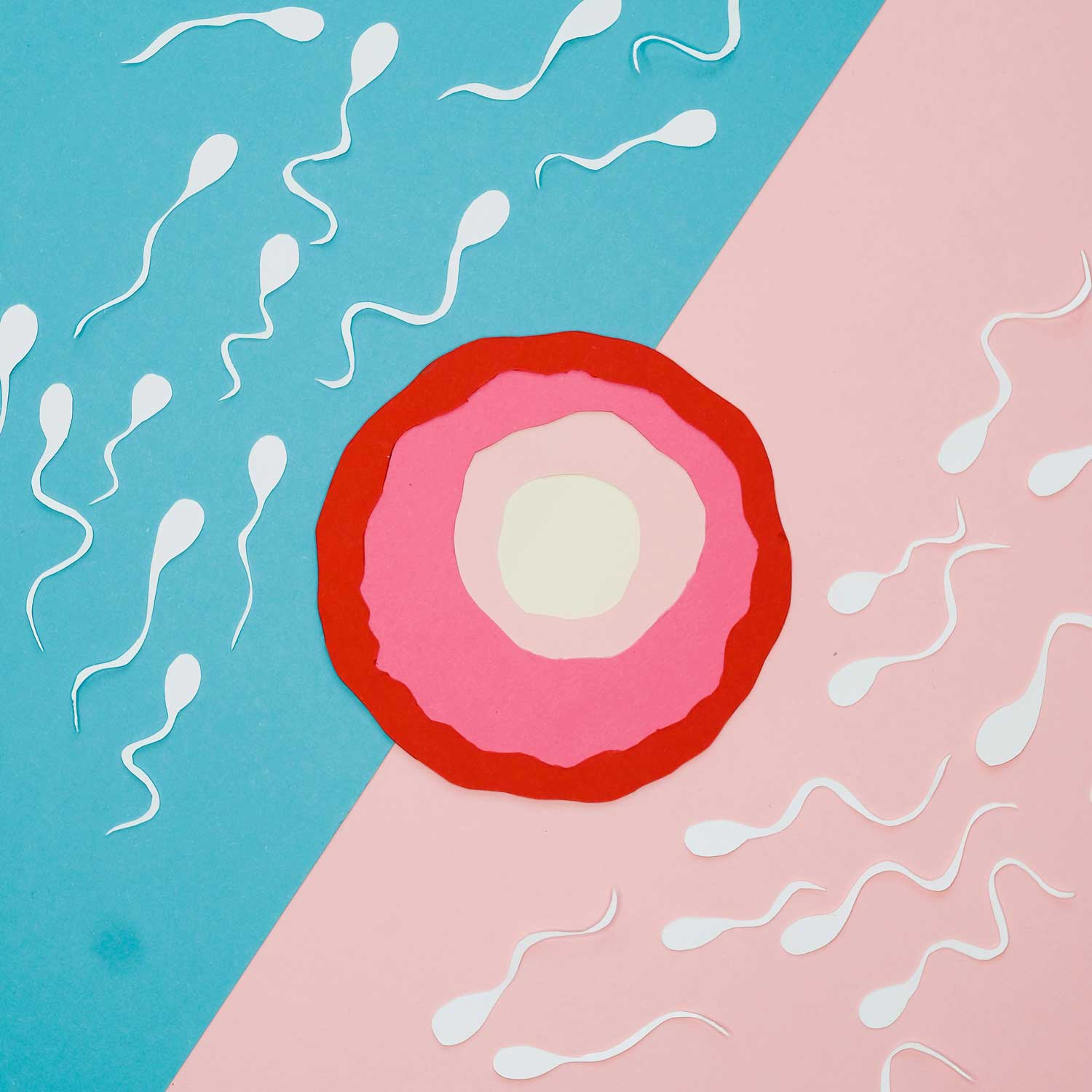 Intracytoplasmic Sperm Injection (ICSI)