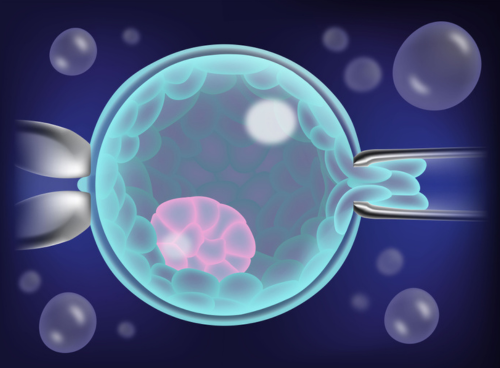 In vitro fertilization (IVF) (minimal and standard stimulation)